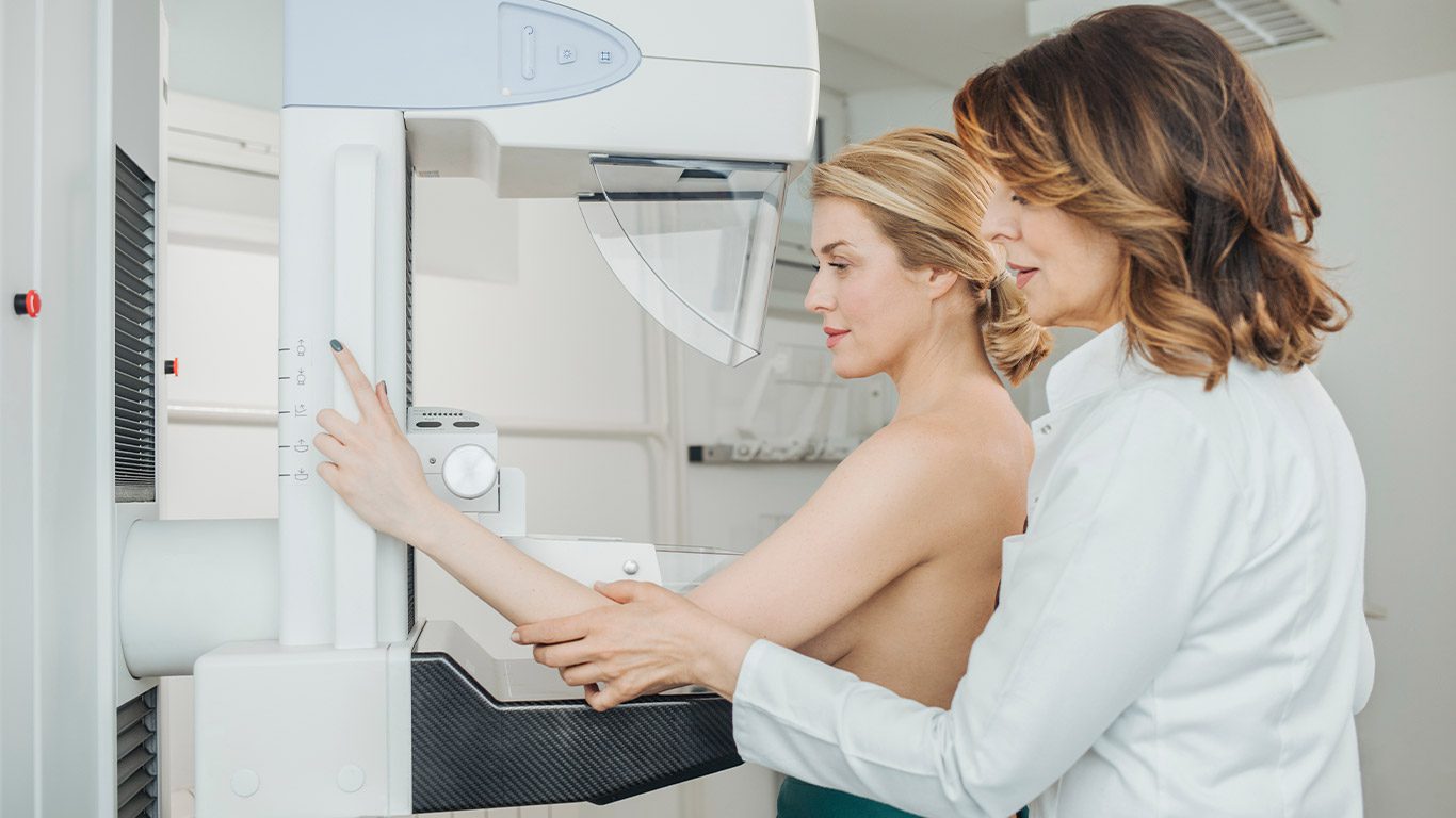 Mamografía: mitos sobre esta prueba