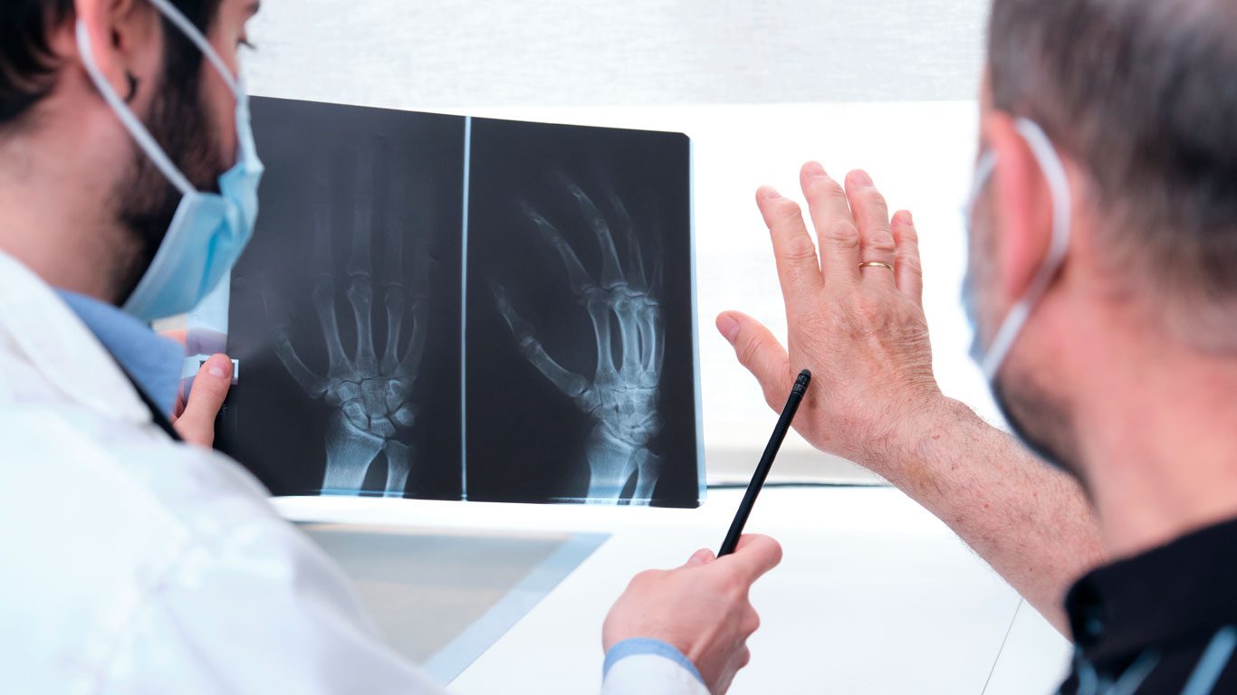 artritis reumatoide Origen Diagnóstico y Traumatología.