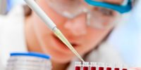 PreveCol: Test en Sangre para Detección del Cáncer Colorrectal