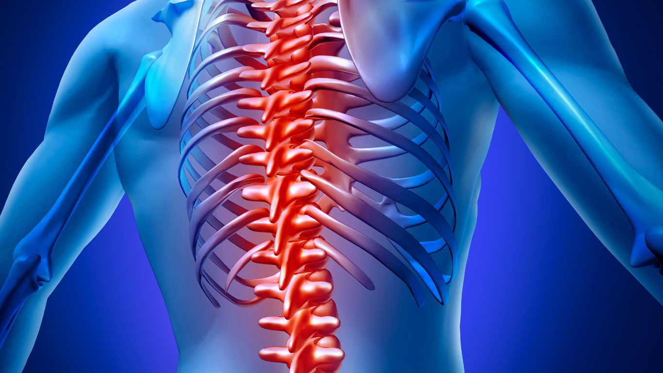 Patologías de la Columna Vertebral Escuela de Espalda