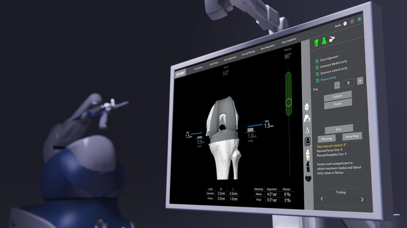 Postoperatorio con MAKO SmartRobotics: la Revolución en Recuperación Articular